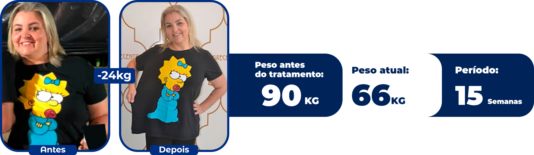 Emagrecentro Resultado Gisele