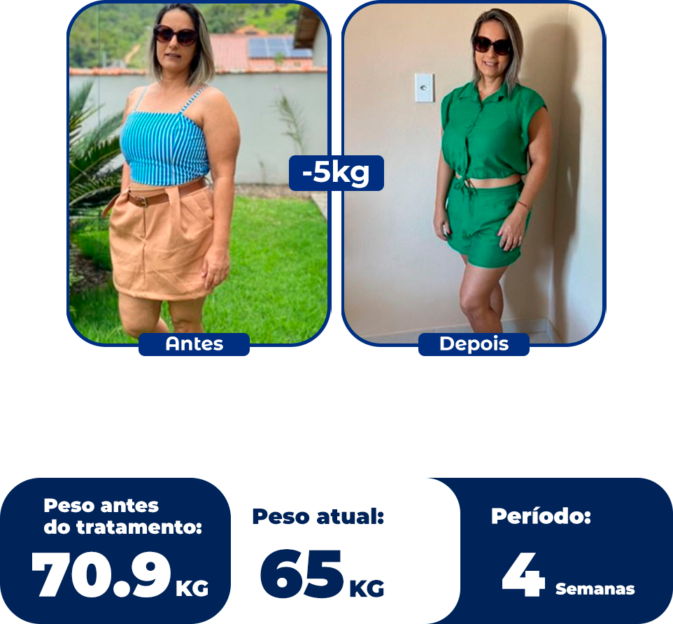 Emagrecentro Resultado Gisele